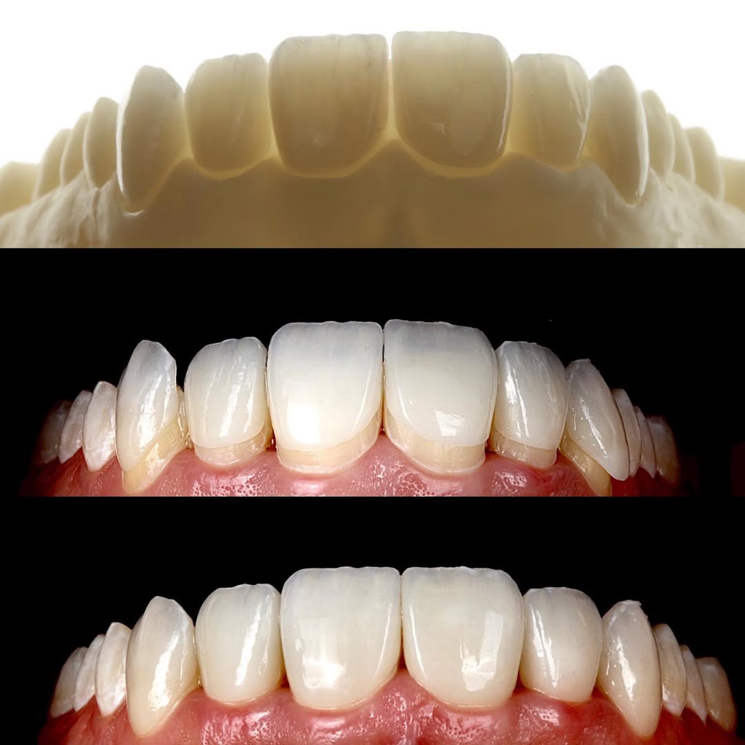 Естетична дентална медицина