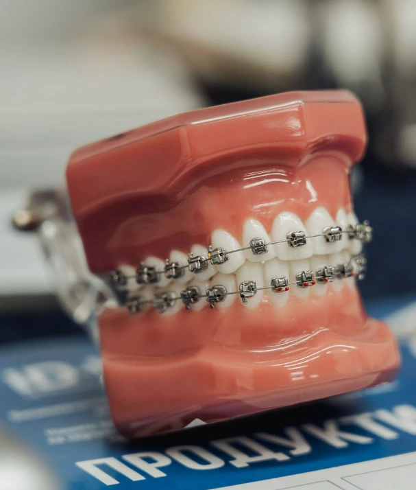 Ортодонтско лечение с брекети